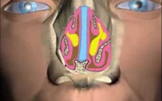 Методы лечения и возможные осложнения при кисте носа