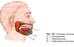 Методы лечения и диагностики кисты в слюнной железе